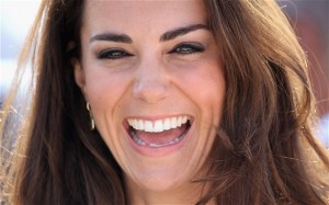 strop Moderne redde The Secret to Kate Middleton's SMILE! in Naperville | Thomas F. Brown, DDS