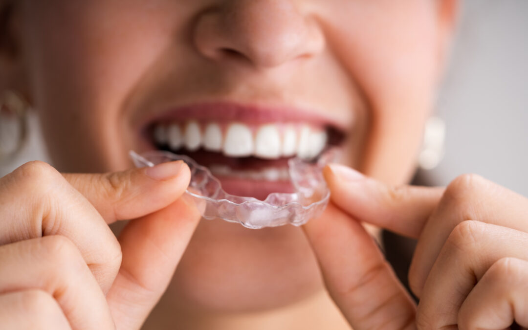 woman smiling and holding night guard up to her mouth