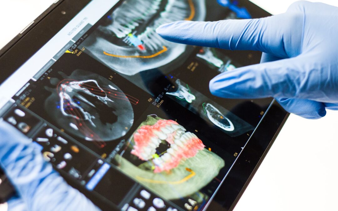 Tablet displaying dental x-rays at a general dentistry clinic