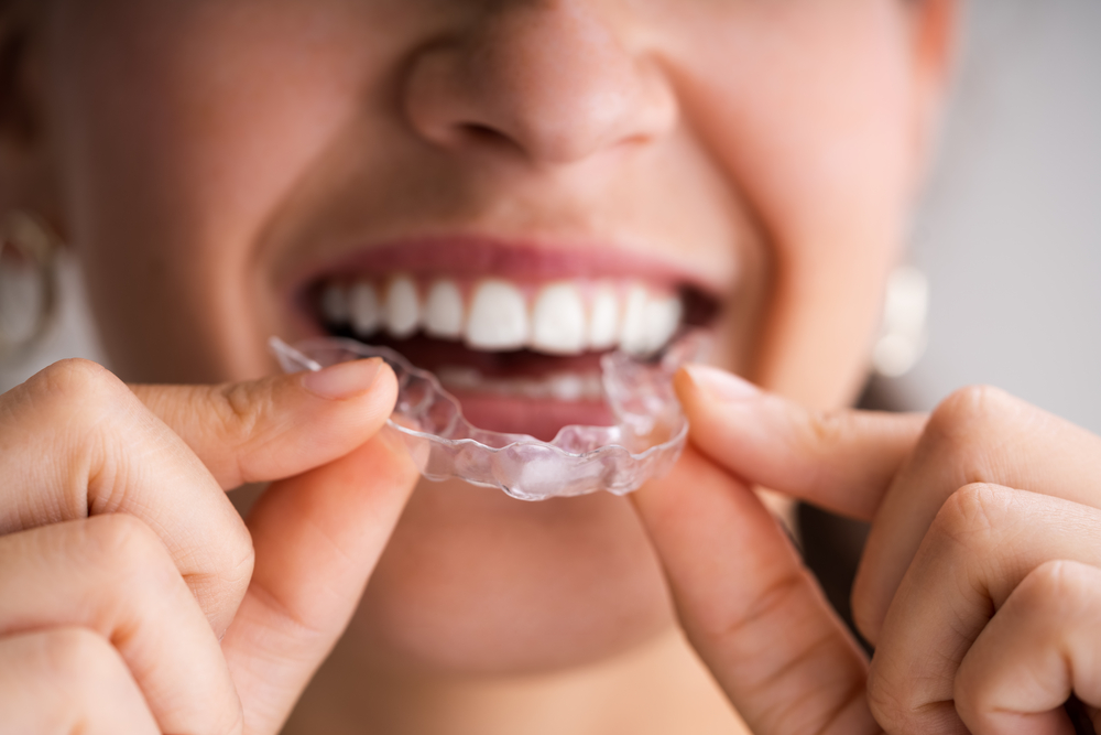 woman holding invisalign clear aligner up to her mouth