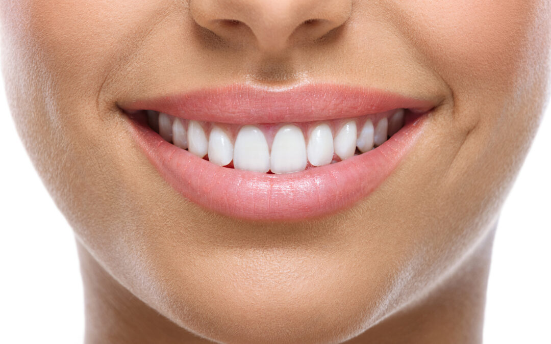close up of woman's perfect smile after BOTOX treatment