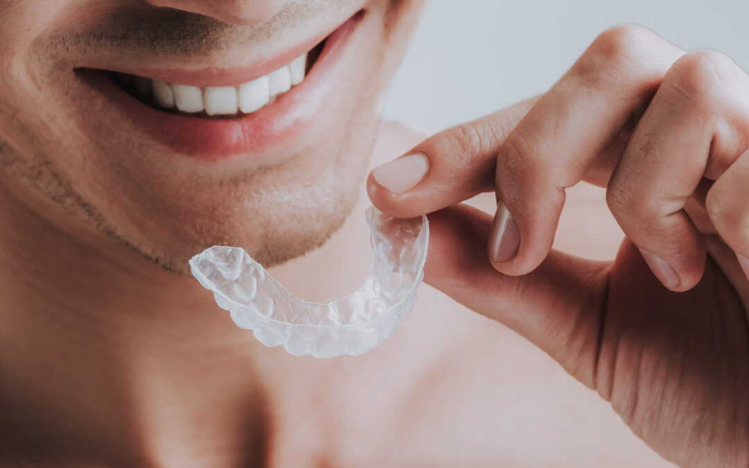 Cheerful young man smiling and holding a transparent mouthguard near his teeth