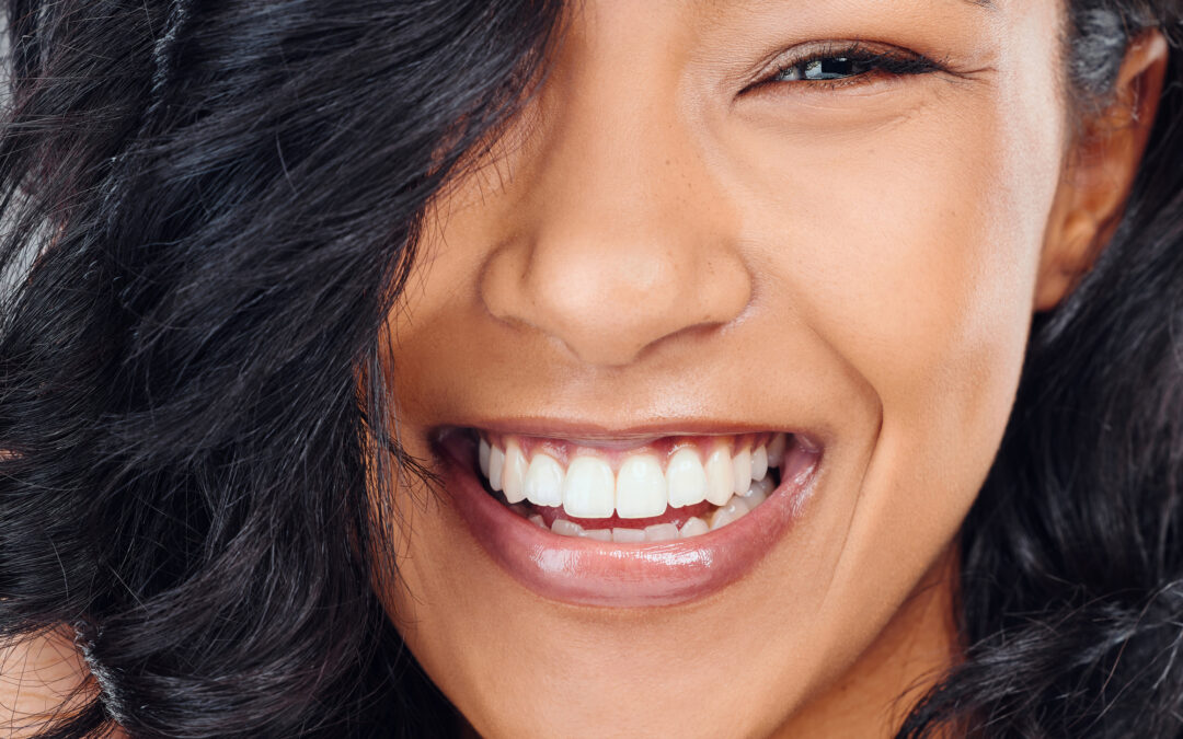 woman smiling after teeth whitening treatment