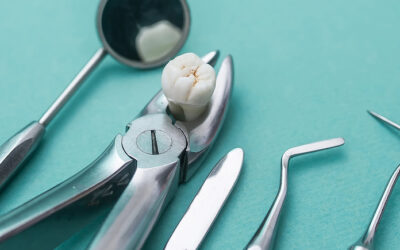 Naperville Dentist Explains: Why Tooth Extraction? Part 2