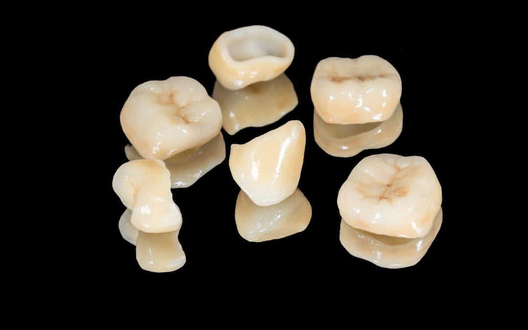 Dental crowns scattered on a black background to demonstrate the differences between same day crowns vs. traditional dental crowns