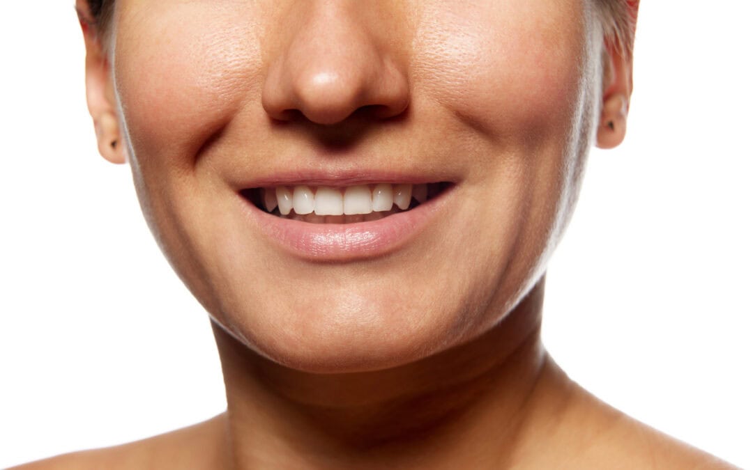 Image of a woman's face from the cheekbones down, depicting a beautiful smile after getting botox for dentistry