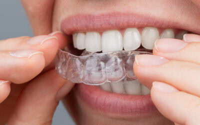 Think You’re Too Old for Invisalign®? Think Again.