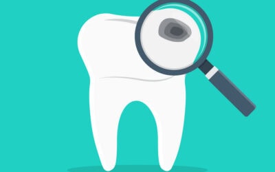 I’m Doing Everything Right, So Why Am I Still Getting Cavities?